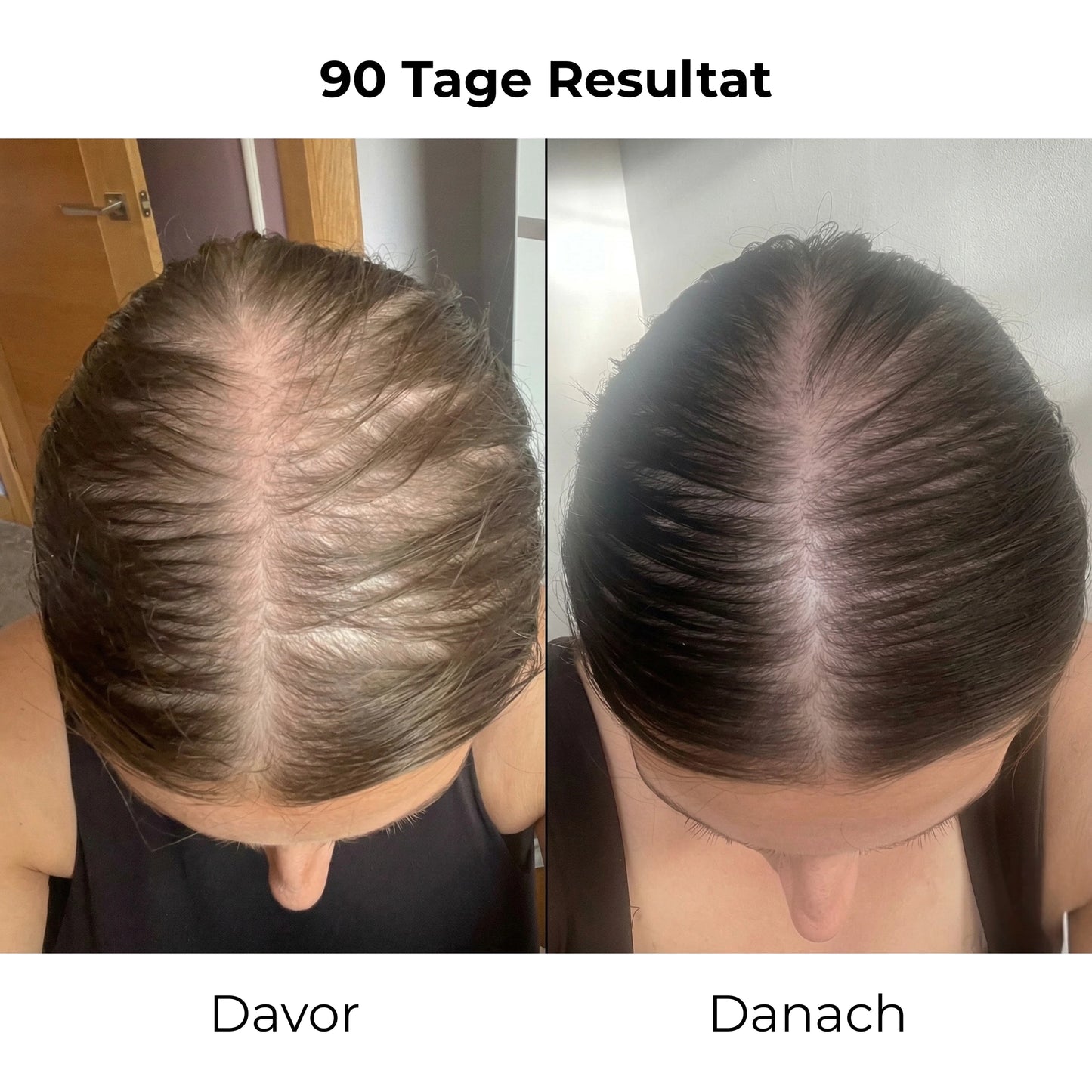 Reclara Bürste – Die Natürliche 4-in-1 Haarwuchsbürste