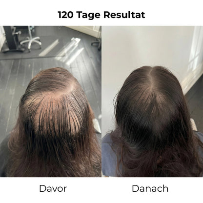 Reclara Bürste – Die Natürliche 4-in-1 Haarwuchsbürste